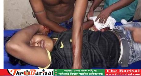 হিজলায় বোমা বানাতে গিয়ে উড়ে গেল যুবকের হাতের কব্জি