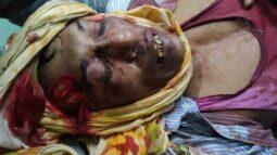হিজলায় করে বড় ভাইয়ের পা কর্তন ॥ ভাবিকে কুপিয়ে জখম
