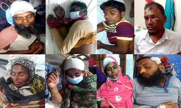 কলাপাড়ায় দু’পক্ষের সংঘর্ষে নারীসহ জখম ১০