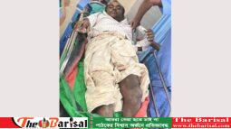 ইউপি চেয়ারম্যানের সমালোচনা করায় ভেঙে দেওয়া হলো আ’লীগ নেতার পা