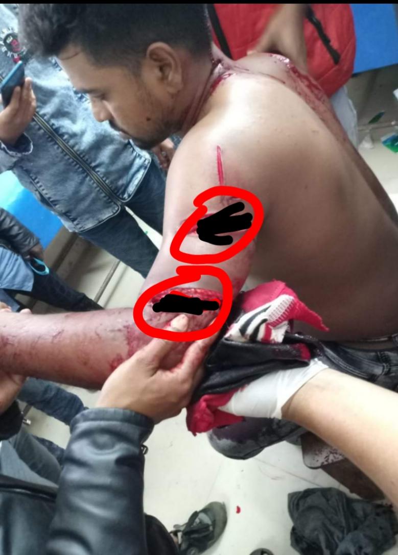 কলাপাড়ায় ছাত্রলীগ নেতাকে কুপিয়ে জখম