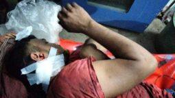 সকালে বাড়িতে অগ্নিসংযোগ, রাতে কুপিয়ে জখম