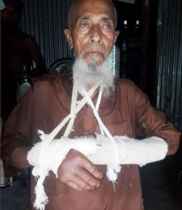ভরণপোষন চাওয়ায় বৃদ্ধ বাবাকে পিটিয়ে দুই হাত ভেঙে দিল ছেলে