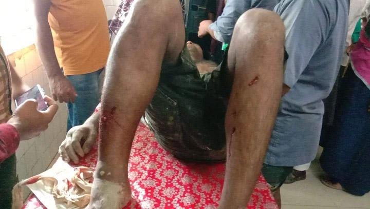 বরগুনায় নৌকার কর্মী-সমর্থকদের ওপর স্বতন্ত্র প্রার্থীর নেতৃত্বে হামলা