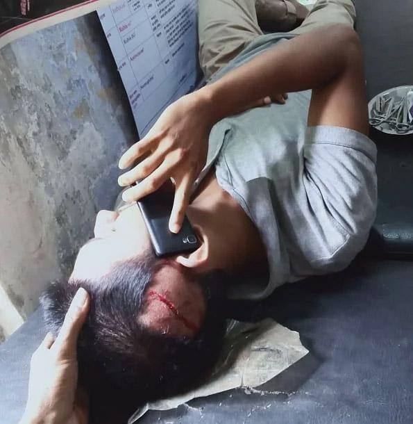 ইউপি কার্যালয়ের সিলিং ফ্যান খুলে পড়ে আহত ২