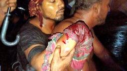 কলাপাড়ায় ছাত্রলীগ নেতার ডান হাতের কব্জি কর্তন