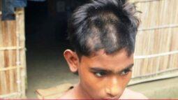 আগৈলঝাড়ায় মোবাইল চুরির অপবাদে শিশুকে গাছে বেধে নির্যাতন ॥ আটক ১
